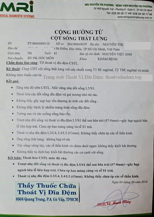 Thoát vị đĩa đệm 